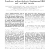 A fast solution to robust minimum variance beamformer and application to simultaneous MEG and local field potential