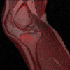 Adaptive non-rigid registration of 3D knee MRI in different pose spaces