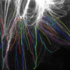 Automatic Quantification of Microtubule Dynamics