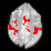 Controlling the error in FMRI: Hypothesis testing or set estimation?