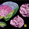 Cortical Surface Flattening Using Least Square Conformal Mapping with Minimal Metric Distortion