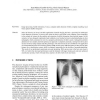 Detection of Normality/Pathology on Chest Radiographs using LBP