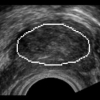 Fast model based segmentation of ultrasound data using an active image