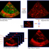 Echocardiogram View Classification using Edge Filtered Scale-invariant Motion Features