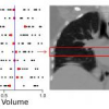 Simultaneous data volume reconstruction and pose estimation from slice samples