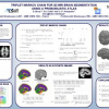 Triplet Markov chain for 3D MRI brain segmentation using a probabilistic atlas