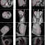 Constrained Marginal Space Learning for Efficient 3D Anatomical Structure Detection in Medical Images