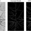 Learning Rotational Features for Filament Detection