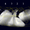 Similarity Metrics and Efficient Optimization for Simultaneous Registration