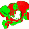 Estimation of linear deformations of 3D objects