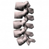 A hierarchical statistical modeling approach for the unsupervised 3D reconstruction of the scoliotic spine