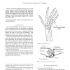 A New Metacarpophalangeal Joint Prosthesis