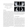A novel type of compliant and underactuated robotic hand for dexterous grasping