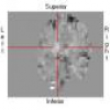 A spatially robust ICA algorithm for multiple fMRI data sets