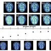 A Unified Information-Theoretic Approach to the Correspondence Problem in Image Registration