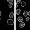 Advanced level-set based multiple-cell segmentation and tracking in time-lapse fluorescence microscopy images