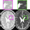 An Integrated Segmentation and Classification Approach Applied to Multiple Sclerosis Analysis
