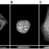 Automated determination of protein subcellular locations from 3D fluorescence microscope images