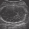 Automatic contour estimation in fetal ultrasound images