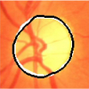 Comparison of Colour Spaces for Optic Disc Localisation in Retinal Images