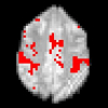 Controlling the error in FMRI: Hypothesis testing or set estimation?