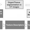 Curvelet-Based Texture Classification of Tissues in Computed Tomography