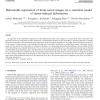 Deformable Registration of Brain Tumor Images Via a Statistical Model of Tumor-Induced Deformation