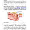 Developing a Next Generation Colonoscopy Simulator