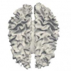 Effect of minicolumnar disturbance on dyslexic brains: an MRI study