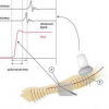 Evaluation of Arterial Endothelial Function Using Transit Times of Artificially Induced Pulses