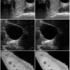 Image Reconstruction using the Benford Law