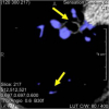 Locally adaptive fuzzy pulmonary vessel segmentation in contrast enhanced CT data