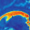 Locally-Constrained Region-Based Methods for DW-MRI Segmentation