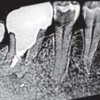Medical image registration using Phase-Only Correlation for distorted dental radiographs