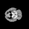Mixture principal component analysis for distribution volume parametric imaging in brain PET studies