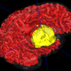 Model-Based Brain and Tumor Segmentation
