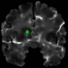 Morphological Classification of Medical Images using Nonlinear Support Vector Machines