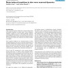 Noise-induced transitions in slow wave neuronal dynamics