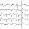Nonlinear classification of EEG data for seizure detection
