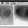 Nonlinear Distortion Correction in Endoscopic Video Images