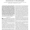 Optimal Wavelet Transform for the Detection of Microaneurysms in Retina Photographs