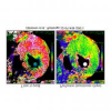 Phase-Correlated Dynamic CT