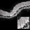 Quantitative analysis of immunofluorescent retinal images