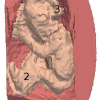 Segmentation of fetal 3D ultrasound based on statistical prior and deformable model