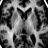 Shape and appearance modeling with feature distributions for image segmentation