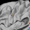 Shape-based Discrimination and Classification of Cortical Surfaces