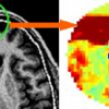 Statistical shape model for automatic skull-stripping of brain images
