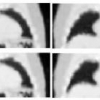 Transforming Static CT in Gated PET/CT Studies to Multiple Respiratory Phases