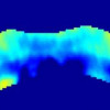 Ultrasound strain imaging: From nano-scale motion detection to macro-scale functional imaging