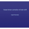 Vessel Driven Correction of Brain Shift